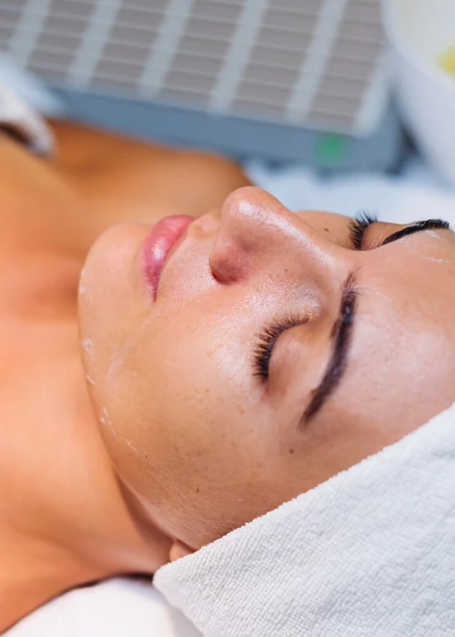 500_700_PEELING.001 viso filler botulino labbra giulia tadiotto cicogna dermatologo dermatologa padova conegliano vittorio veneto
